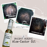 Aloe-Castor Oil 50ml